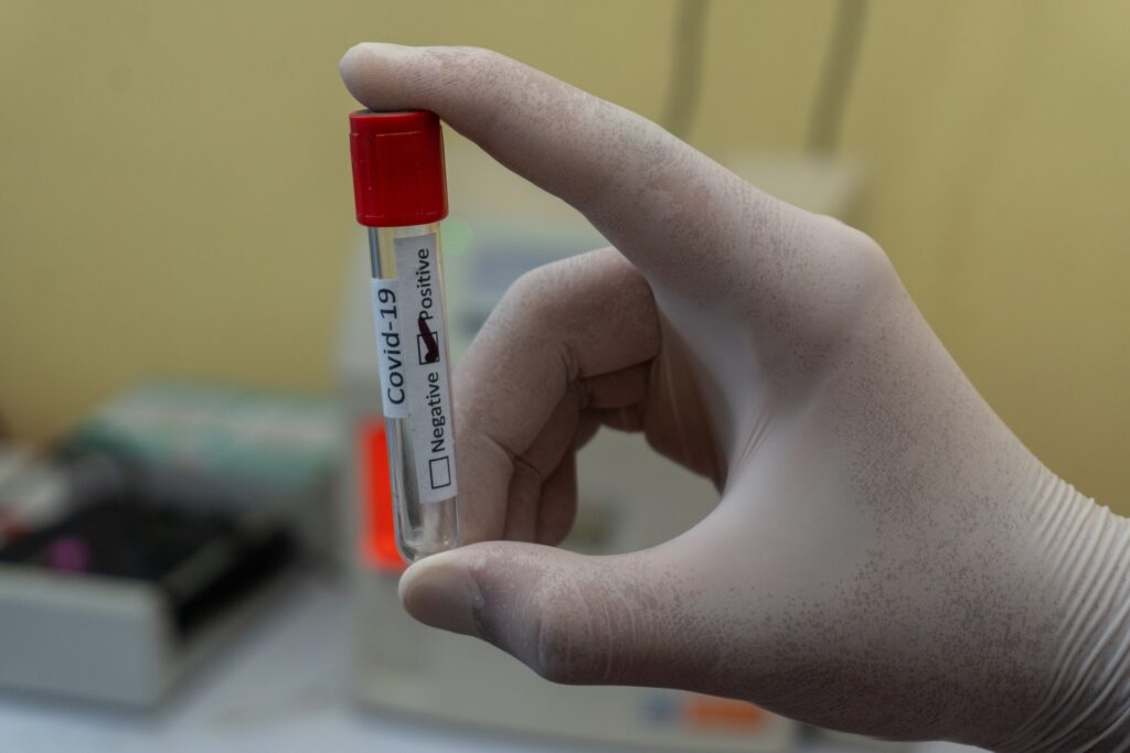 PCR test